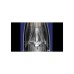 Фен Dyson Supersonic HD16 Nural Vinca Blue/Topaz (515166-01)