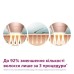 Фотоепілятор Philips BRI977/00